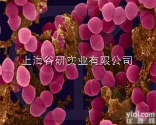 抗<em>人白蛋白</em><em>杂交瘤</em><em>细胞</em>；7G1特价