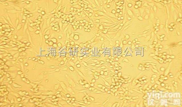 人<em>膀胱</em><em>癌细胞</em>；H/RB-M<em>图片</em>