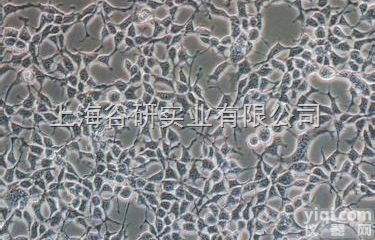 人胶质瘤<em>细胞系</em>U251细胞完全<em>培养基</em>价格