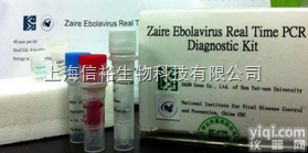 <em>肠道病毒EV71/柯萨奇病毒A16型2联PCR检测试剂盒</em>