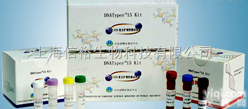 军团菌16S rRNA基因<em>荧光</em>PCR检测<em>试剂盒</em>（探<em>针法</em>）