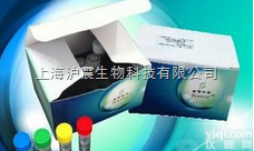 猪<em>内源性</em><em>逆转录</em>病毒（PERV）核酸<em>检测</em>试剂盒（RT-PCR法）