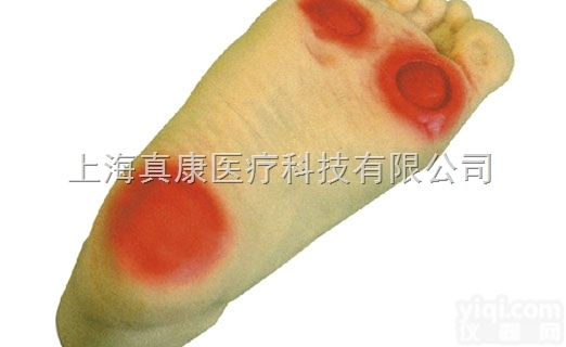 KAH-HS19  高级<em>糖尿病足</em><em>护理模型</em>KAH-HS19