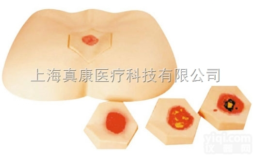 KAH-RC-3  <em>阶段</em><em>褥疮</em><em>护理模型</em>KAH-RC-3