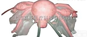 <em>子宫</em>及附件<em>模型</em>