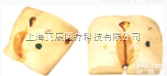 <em>KAH</em>-RC  高级压疮（<em>褥疮</em>）<em>护理模型</em>