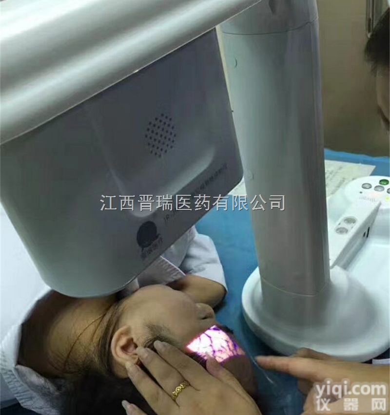 晋瑞静脉<em>血管显像仪</em>  晋瑞静脉<em>血管显像仪</em>江西厂家电极片