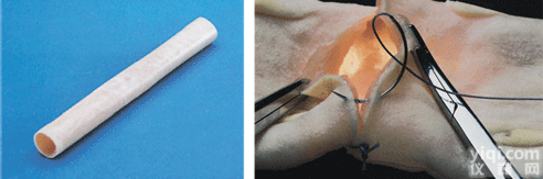 KAH-CWH-2  肠管吻合<em>模型</em>（20mm） <em>临床</em>综合专科