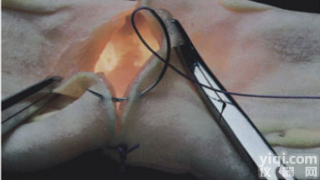 KAH-CWH-1  肠管吻合<em>模型</em>（30mm） <em>临床</em>综合专科