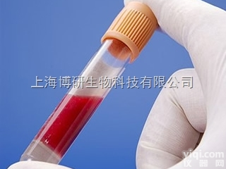 脂肪营养素PNPLA3<em>抗体</em>,Anti-PNPLA3<em>抗体</em>产品<em>报价</em>