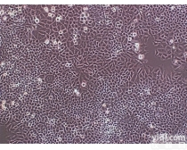 <em>大鼠原代腹腔主动脉内皮细胞</em>