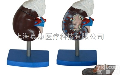 KAH/A310-3  肾<em>解剖</em>附<em>肾上腺</em>模型 人体各大器官