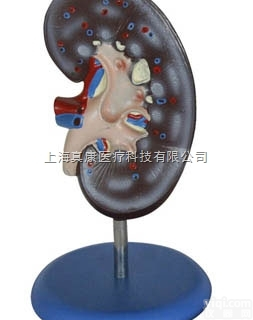 <em>KAH/A310-1  肾解剖模型1件 人体各大器官</em>