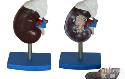 KAH/A310-3  肾<em>解剖</em>附<em>肾上腺</em>模型 人体各大器官