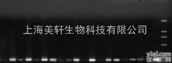 甲基化检测/甲基化分析/<em>DNA甲基化检测</em>/甲基化检测BSP/MSP法