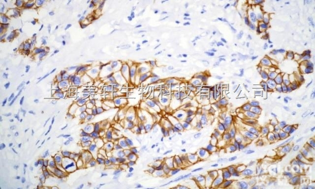 <em>原位</em><em>杂交</em>/<em>原位</em><em>杂交</em>/CISH/组织<em>原位</em><em>杂交</em>/细胞<em>原位</em><em>杂交</em>