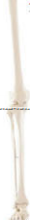 SMD00113  <em>下肢</em>骨  <em>教学模型</em>