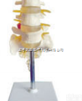 SMD01524  腰骶椎与神经<em>模型</em>（3个<em>腰椎</em>） 教学<em>模型</em>