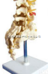 SMD01523  腰骶椎与神经<em>模型</em>（4个<em>腰椎</em>）  教学<em>模型</em>