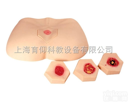 阶段<em>褥疮</em><em>护理模型</em>|护理训练模型