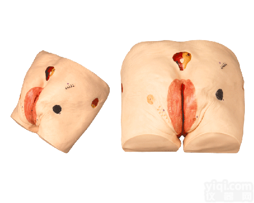 高级压疮（<em>褥疮</em>）<em>护理模型</em>|护理训练模型