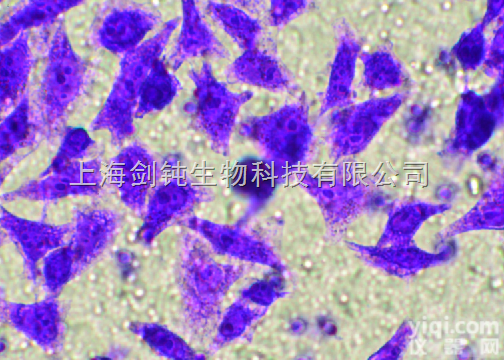 <em>Transwell</em>细胞<em>侵袭</em>实验