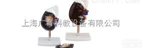 肾<em>解剖</em>附<em>肾上腺</em>模型泌尿系统
