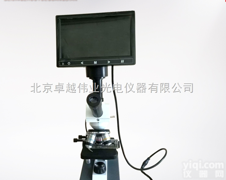 301C  北京 高清<em>螨虫检测仪</em> 一滴血检测仪