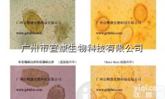 <em>寄生虫卵检测制片盒</em>（100次）/寄生虫卵检测试剂盒（改良加藤氏法）