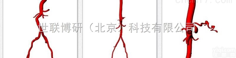 人造<em>血管</em>，<em>血液</em>类似物  人造<em>血管</em>（Intracranial Aneurysm vascular...