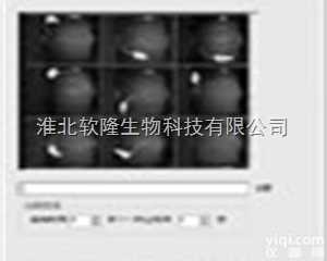 HB  学习<em>记忆</em><em>认知</em>类  自发活动分析系统