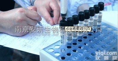 <em>Thymulin</em>抗体  <em>胸腺素</em>抗体