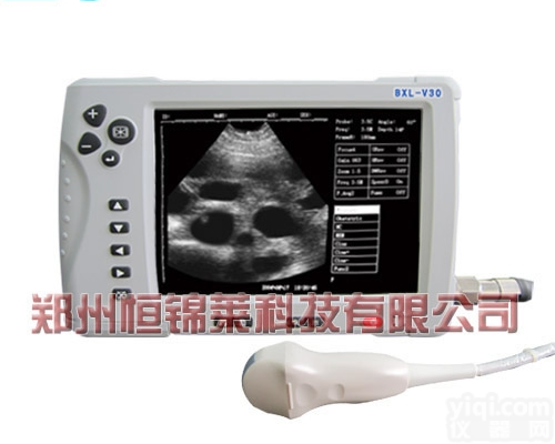 国产兽用B超机<em>便宜</em>的<em>多少</em>钱