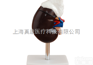肾<em>解剖</em>附<em>肾上腺</em>模型