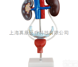 <em>女性</em><em>泌尿</em>生殖<em>系统</em>解剖模型
