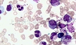 猪<em>胚胎</em><em>睾丸</em><em>传代</em>细胞；ST培养