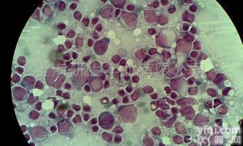 <em>抗肿瘤</em>坏死因子α<em>小鼠</em><em>杂交瘤</em>细胞；7A8品Pai