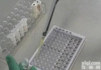 人表面膜免疫<em>球蛋白</em>D（mIgD<em>酶联免疫</em><em>试剂盒</em>