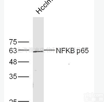 膀胱癌和乳腺癌过表达<em>基因</em><em>抗体</em>LENG4<em>说明书</em>