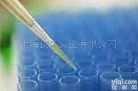 细胞<em>纤毛</em>内转运<em>同源</em>蛋白20<em>抗体</em>