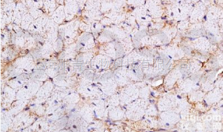 <em>醋酸</em>阿托西班<em>抗体</em>