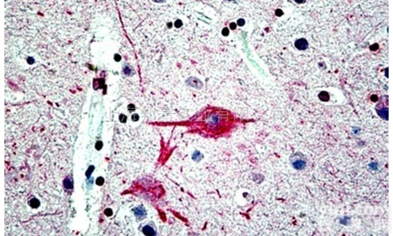 <em>肿瘤坏死因子诱导蛋白3相互作用蛋白1抗体</em>