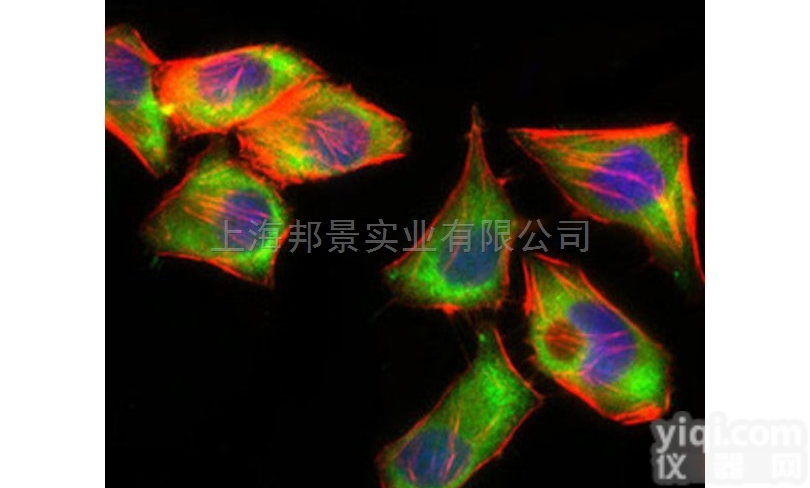 血小板反应<em>蛋白</em>2/<em>凝血酶</em>敏感<em>蛋白</em>2<em>抗体</em>