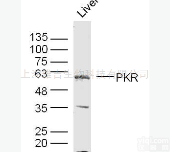丝裂原活化蛋白<em>激酶</em><em>激酶</em><em>激酶</em>4<em>抗体</em>MLK4<em>抗体</em>