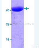 肌球<em>蛋白</em>结合<em>蛋白</em>H样<em>蛋白</em><em>抗体</em>MYBPHL<em>说明书</em>