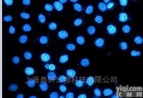 <em>细胞</em>Hoechst<em>凋亡</em>染色
