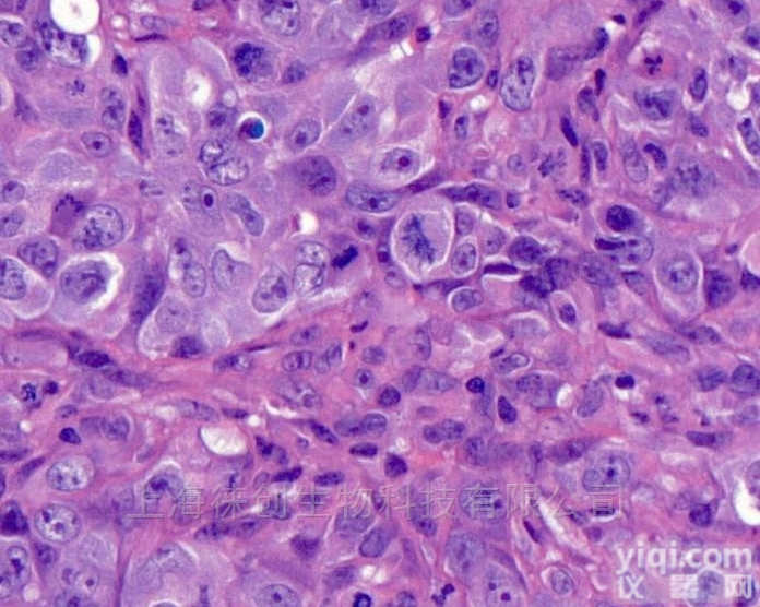 <em>免疫</em>组化及互作<em>实验</em>HE染色<em>技术服务</em>