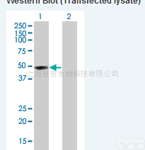 <em>冠状</em>病<em>毒刺</em>突糖<em>蛋白</em>抗体说明书