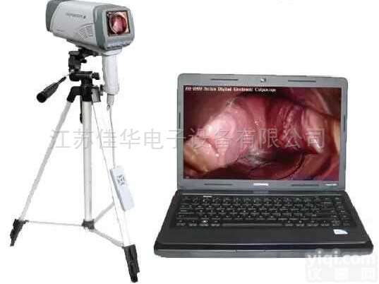 JH-5004  电子阴/道镜 数码阴/道镜 笔记本<em>高清</em><em>阴道</em>镜