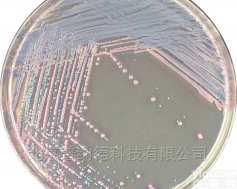 TA670  法国科玛嘉金黄色<em>葡萄球菌</em><em>显色</em><em>培养基</em>